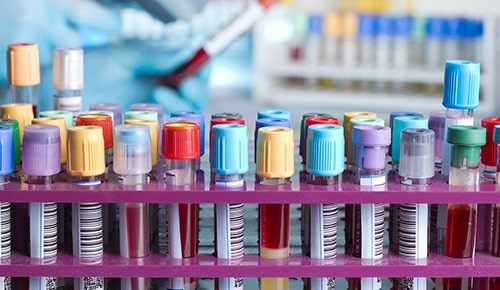 Découvrez les métiers de la bio analyse en alternance avec l'ETSL