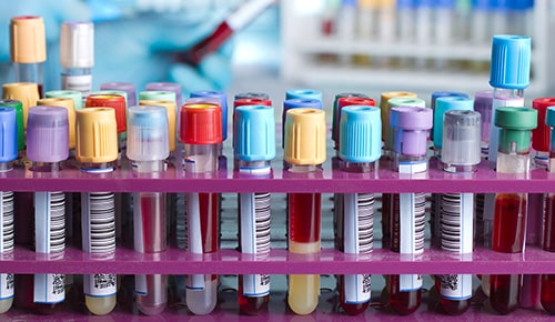 Formation Licence Professionnelle Génomique en apprentissage à l'ENCPB